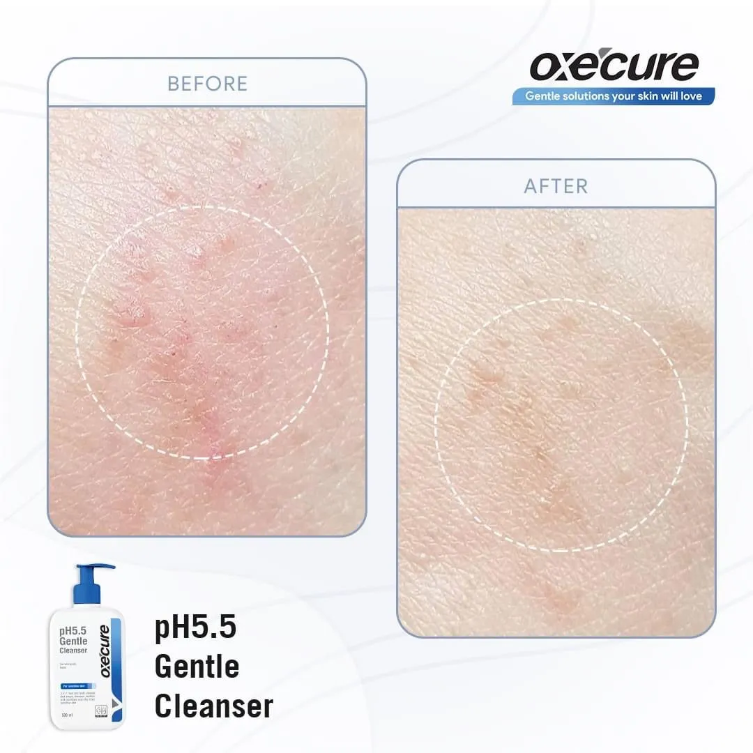 Oxecure pH 5.5 Gentle Cleanser 250ml