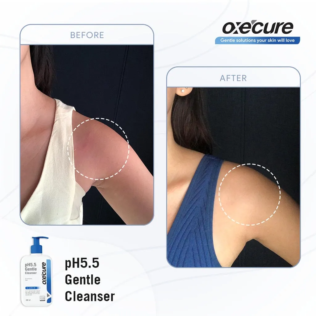 Oxecure pH 5.5 Gentle Cleanser 250ml